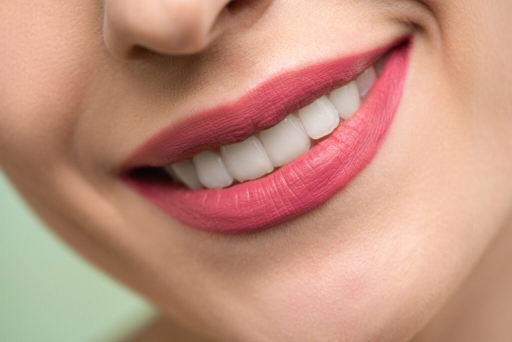 Closeup shot of woman smiling with nice teeth